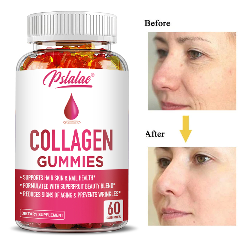 Collagen Gummies - for Overall - огляд і ціна Health Wellness Gummies